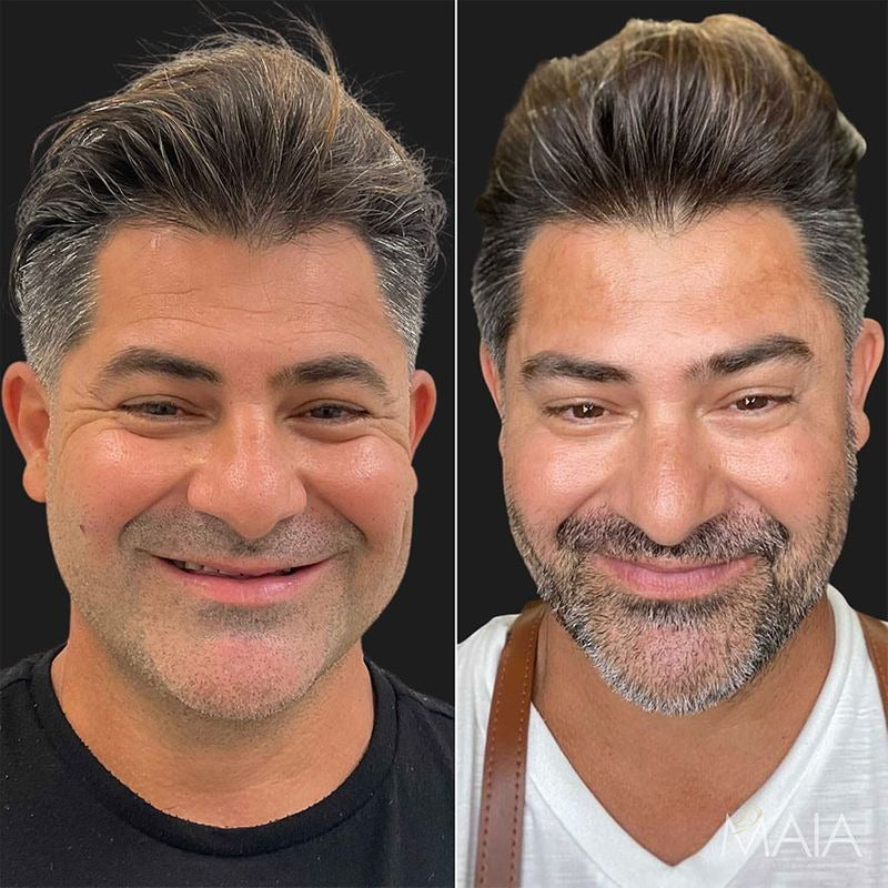 SAAM - Young & Radiance Serum (Original)