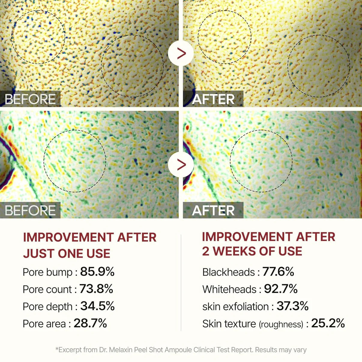 Dr Melaxin Peel Shot