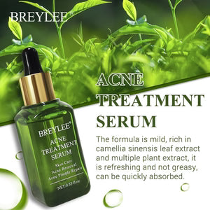عرض رمضاني 🕌خاص بخصم❤️% 30-BREYLEE Acne Treatment Serum – Scar Removal & Pimple Repair Cream