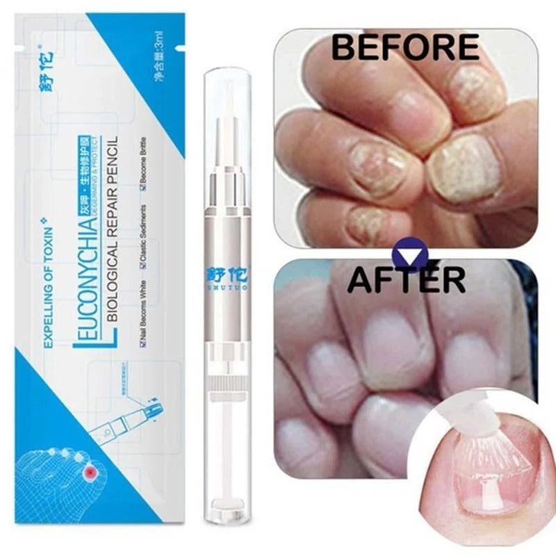 Sumifun - Nail Fungus Treatment Liquid (Original)