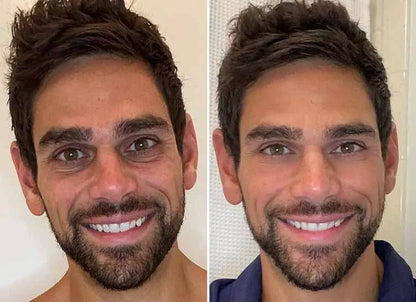 SAAM - Young & Radiance Serum (Original)