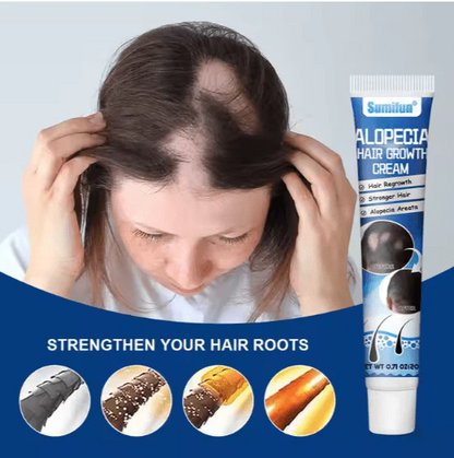 Sumifun  Hair Growth Cream (Original) Natural Treatment for Hair Loss & Regrowth