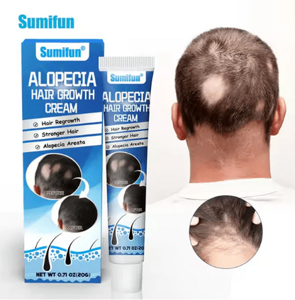 Sumifun  Hair Growth Cream (Original) Natural Treatment for Hair Loss & Regrowth