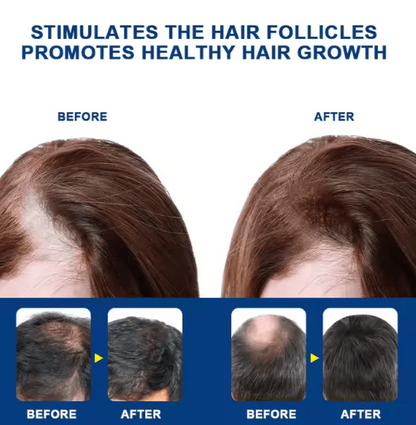 Sumifun  Hair Growth Cream (Original) Natural Treatment for Hair Loss & Regrowth
